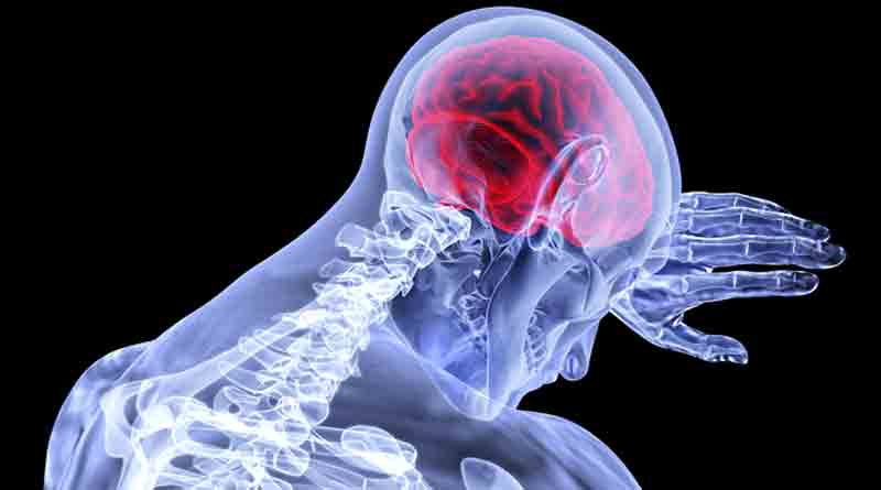 Beyin Check Up’ı Nedir?